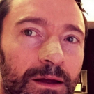 Hugh Jackman Reveals Yet Another Skin Cancer Procedure; Urges Sunscreen Use