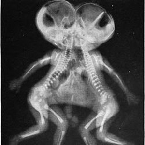 Madison's Fargo WOMB to be Presented at The Rat