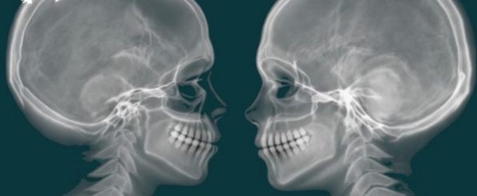 Kristen Cosby Premieres WHEN THE SKELETON DOES NOT STAND At Playground Solofest