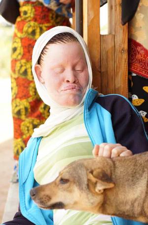 Tanzania Albinism Collective Release New Single Image
