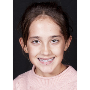 Kora Metcalf - Little Kid